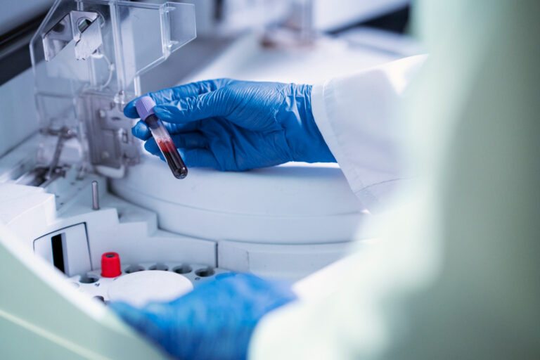 Como a Capela de Exaustão Aumenta a Segurança no Laboratório